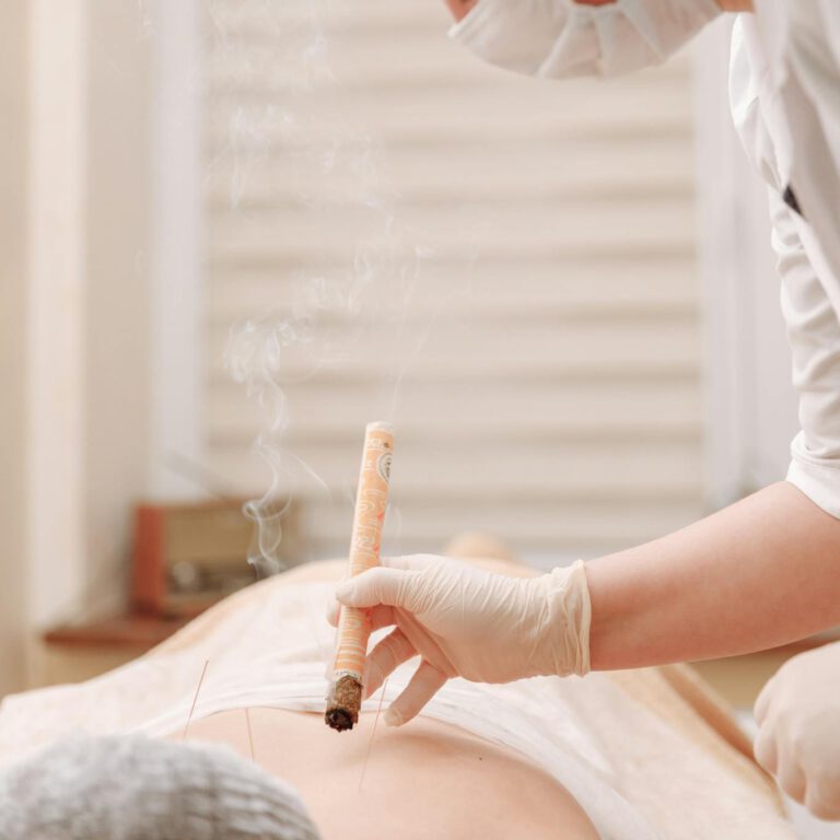 A professional therapist conducting moxibustion therapy in a calm indoor setting.