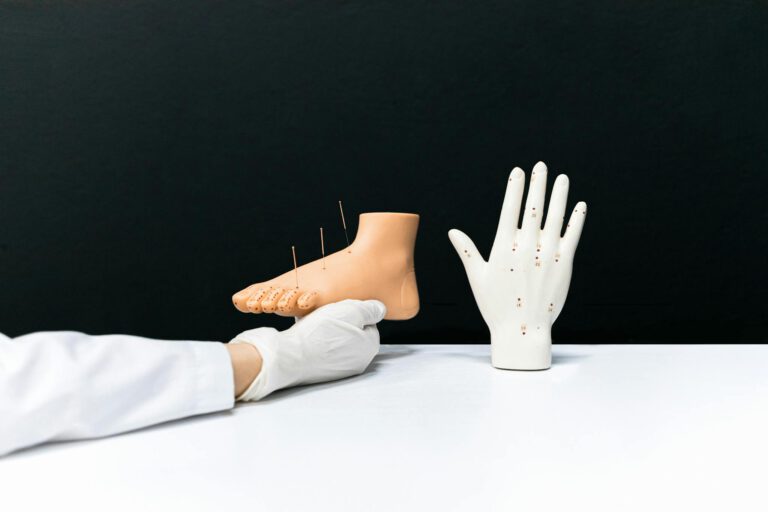 Acupuncture hand and foot models with needles for alternative therapy training.