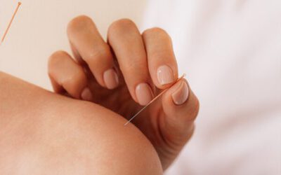Acupunctuur bij angst: Natuurlijke rust voor lichaam en geest